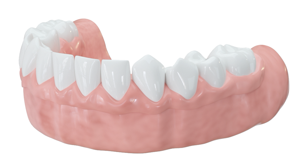 Für feste Zähne an einem Tag wird ein Provisorium auf die Implantate geschraubt.